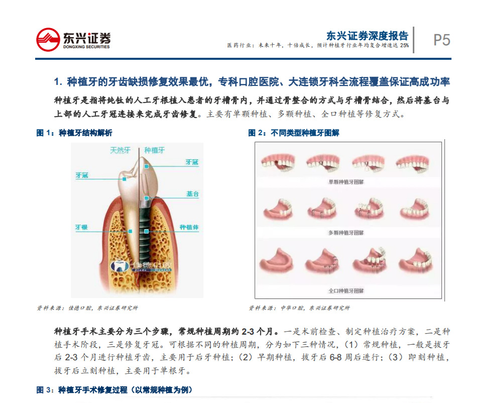 未來(lái)十年，十倍成長(zhǎng)，預(yù) 計(jì)種植牙行業(yè)年均復(fù)合增速達(dá)25%——東興證券